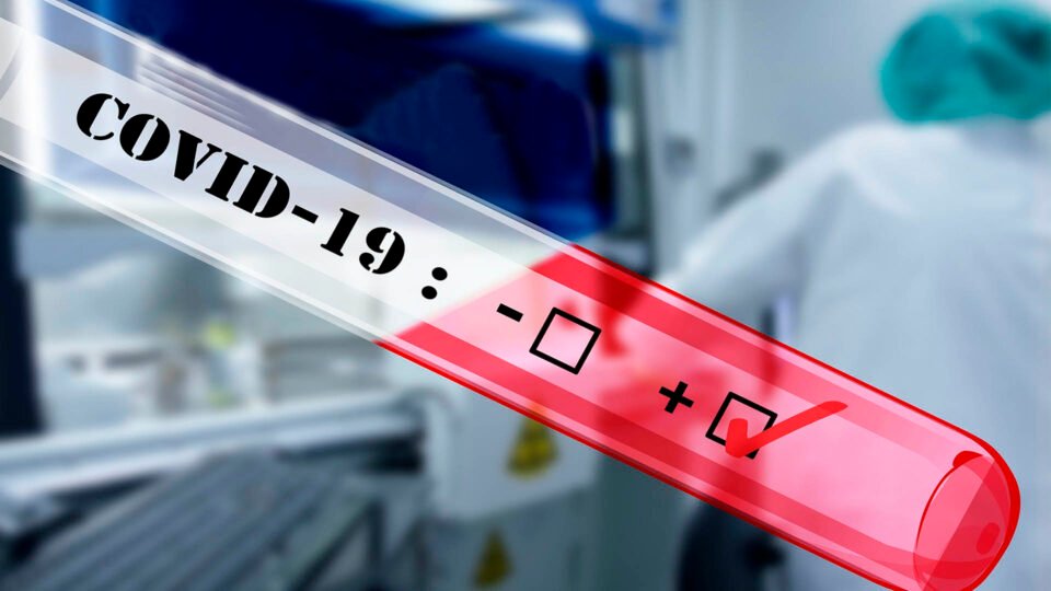 Reporte diario de casos de covid en Jujuy