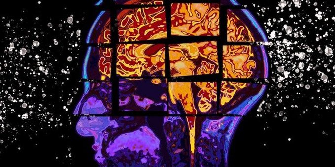 Científicos lograron mapas más detallados del cerebro que ayudarán a tratar la enfermedad de Alzheimer y el Parkinson