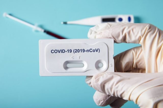 La Anmat avanza en un nuevo kit para detectar el covid-19