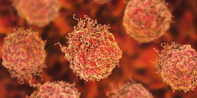 Descubrieron una nueva forma de cáncer de próstata