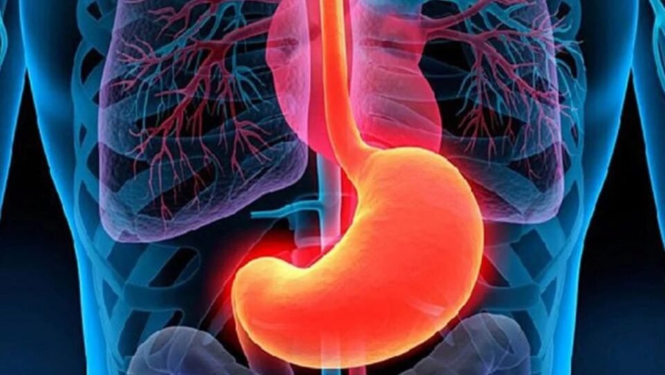Gastritis Erosiva, cuáles son los síntomas?