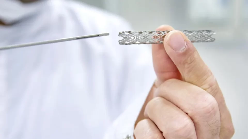 Jujuy: Colocarán Stent de forma gratuita