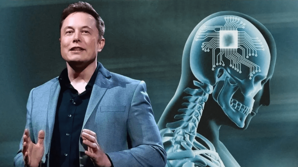 Elon Musk confirmó que implantaron el primer chip cerebral