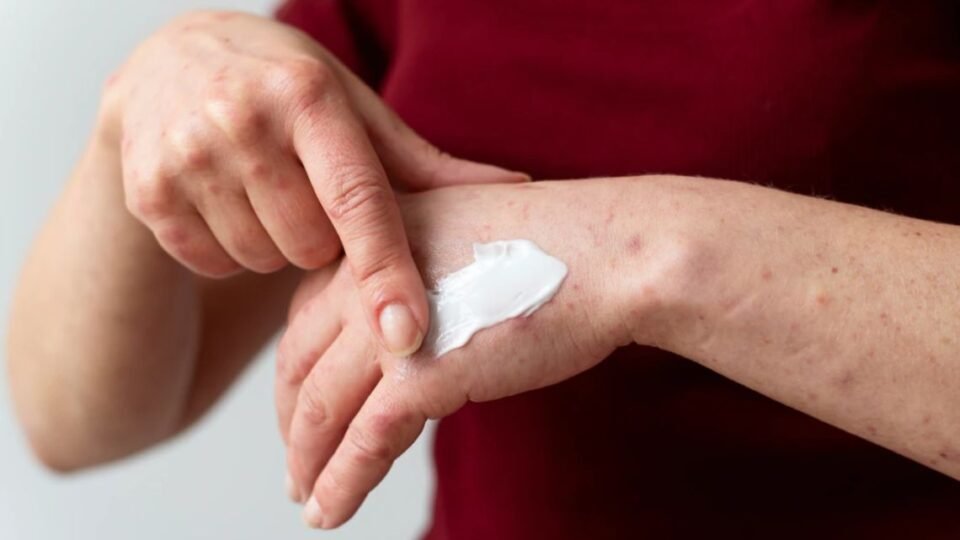 La ANMAT prohibió una crema antiinflamatoria