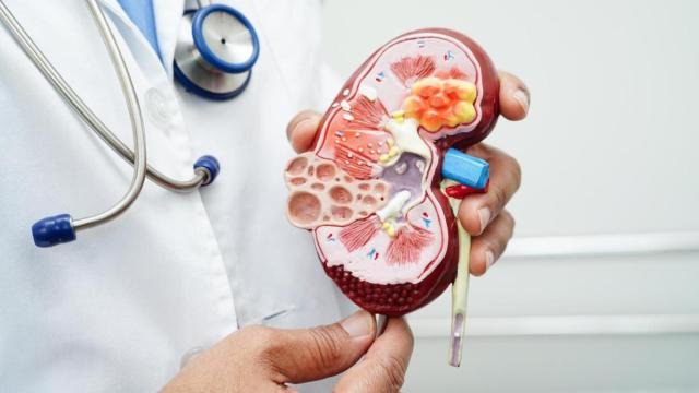 Hoy 19 de junio, Día Mundial del Cáncer de Riñón 