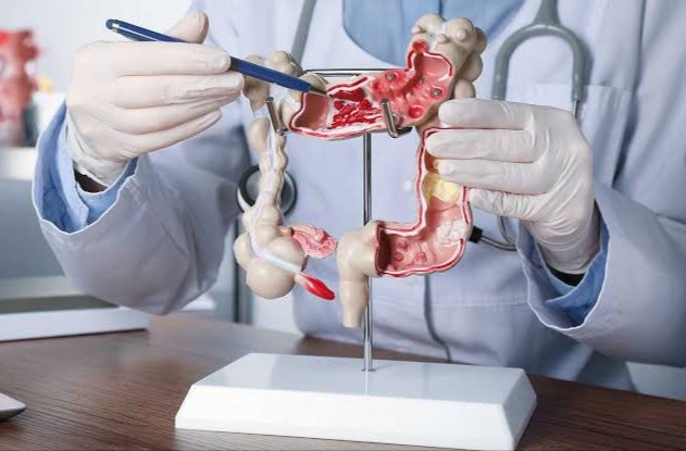 Hoy 31 de marzo, Día Mundial Contra el Cáncer de Colón 