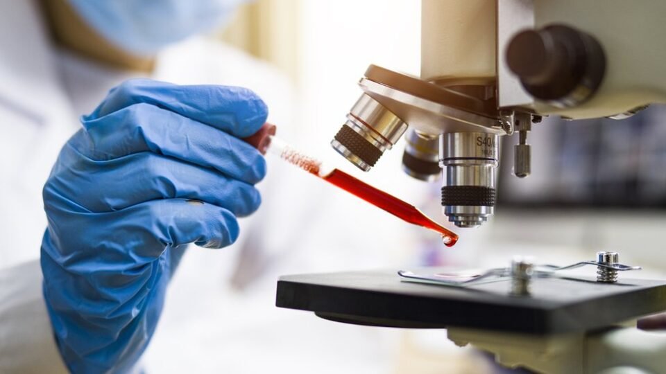 Un nuevo estudio permite detectar el Alzheimer 