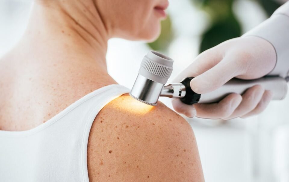 Hoy 23 de mayo, Día Mundial contra el Melanoma 