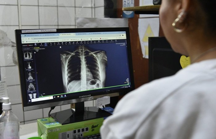 Salud Pública: Jujuy dispone de exámenes digitalizados